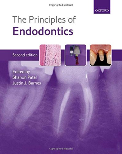 The Principles Of Endodontics- AIBH Exclusive