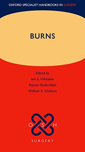 Burns (Oxford Specialist Handbooks in Surgery)- OHB