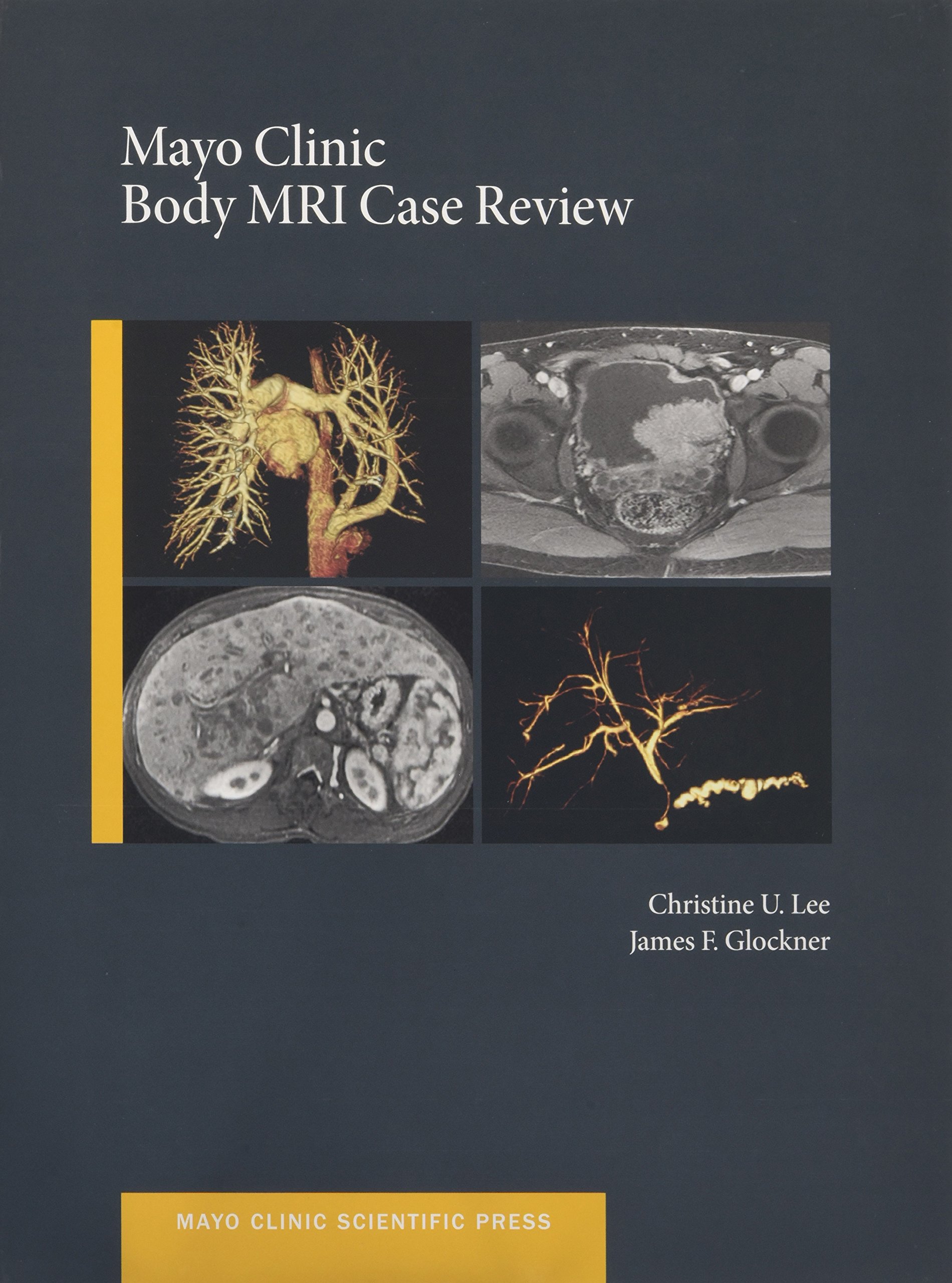 Mayo Clinic Body Mri Case Review- AIBH Exclusive
