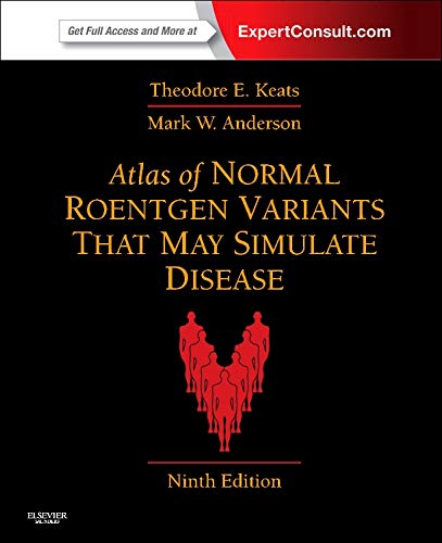 Atlas Of Normal Roentgen Variants That May Simulate Disease: Expert Consult - Enhanced Online Features And Print, 9E