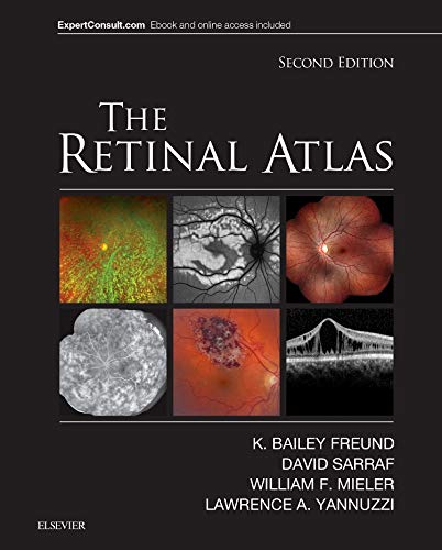 The Retinal Atlas, 2E