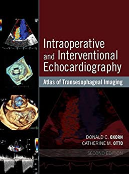 Intraoperative And Interventional Echocardiography: Atlas Of Transesophageal Imaging, 2E