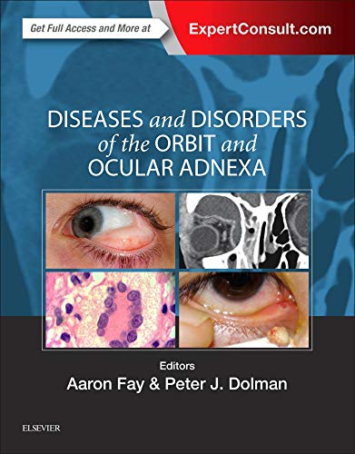 Diseases And Disorders Of The Orbit And Ocular Adnexa: Expert Consult - Online And Print, 1E