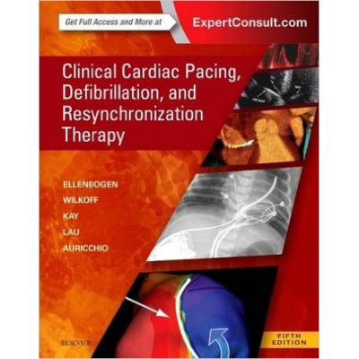 Clinical Cardiac Pacing, Defibrillation And Resynchronization Therapy, 5E