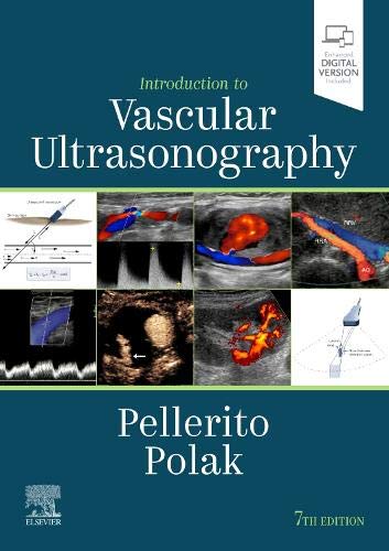 Introduction To Vascular Ultrasonography: Expert Consult - Online And Print, 7E