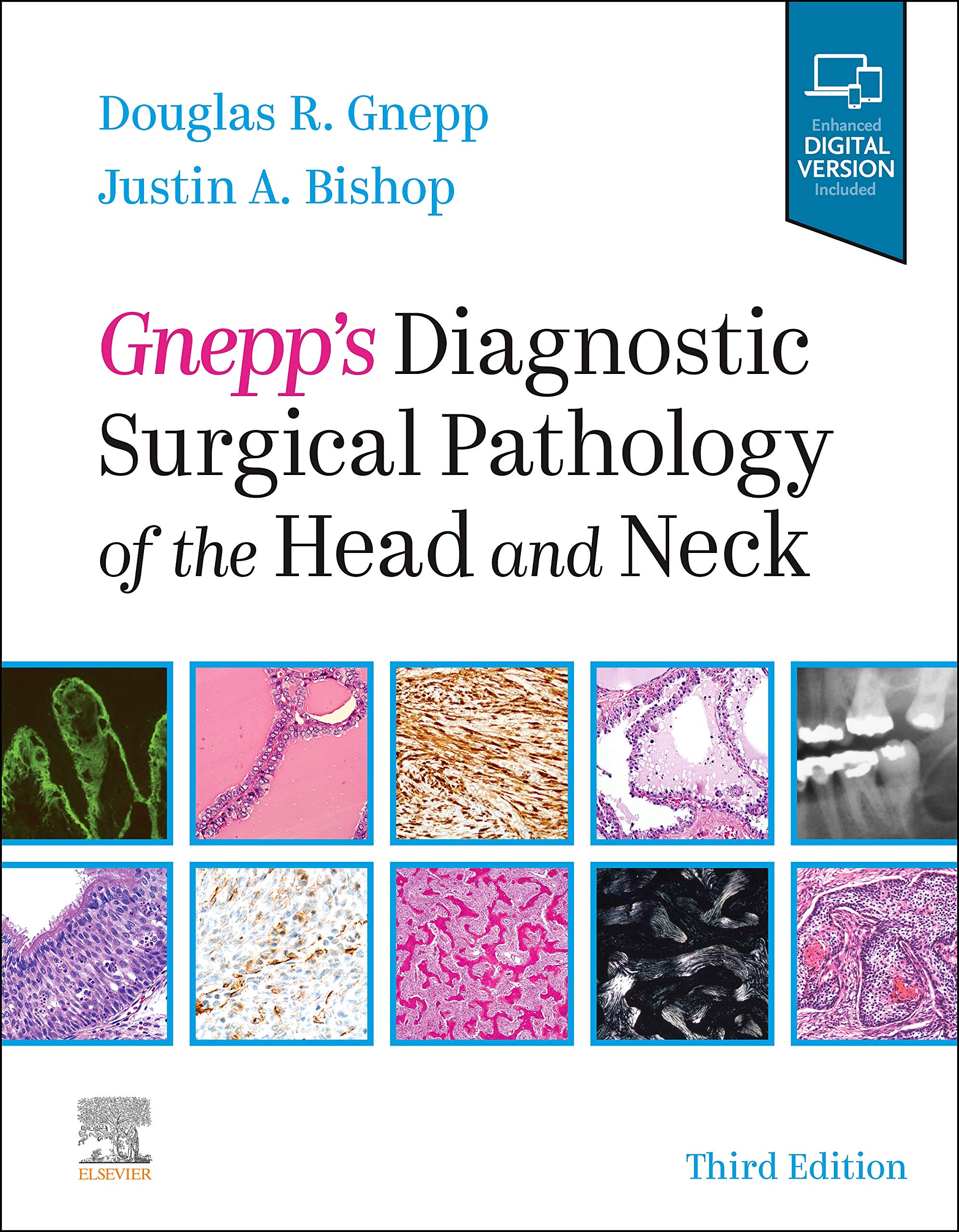 Gnepp'S Diagnostic Surgical Pathology Of The Head And Neck