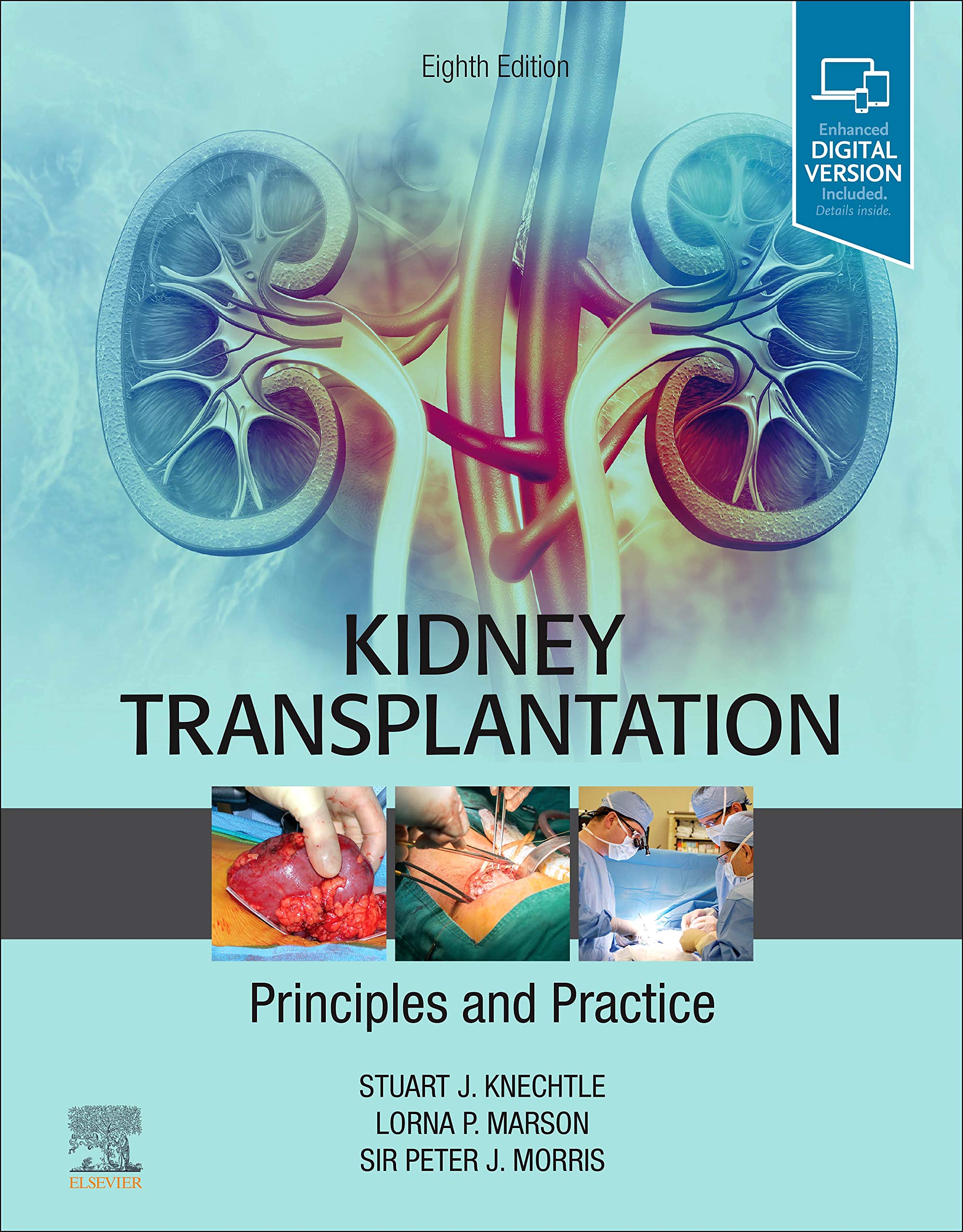 Kidney Transplantation Principle And Practice