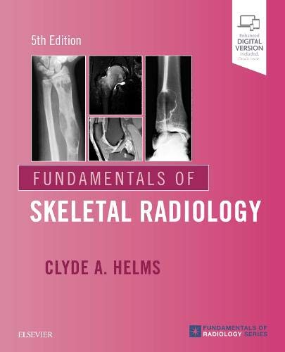 Fundamentals Of Skeletal Radiology: Expert Consult: Online And Print, 5E