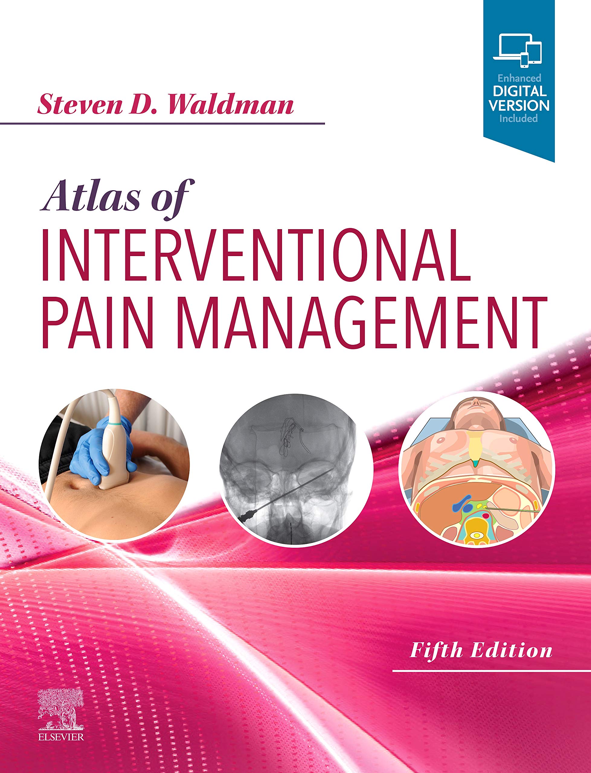 Atlas Of Interventional Pain Management - Expert Consult: Online And Print, 5E