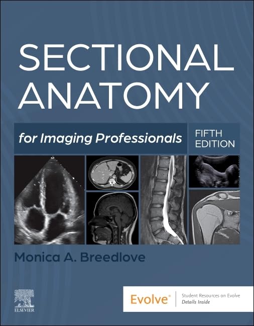 Sectional Anatomy For Imaging Professionals With Access Code 5Ed (Pb 2025)