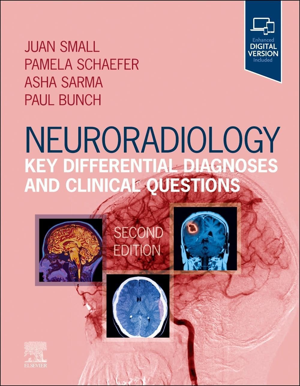 Neuroradiology Key Differential Diagnoses And Clinical Questions With Access Code 2Ed (Pb 2024)