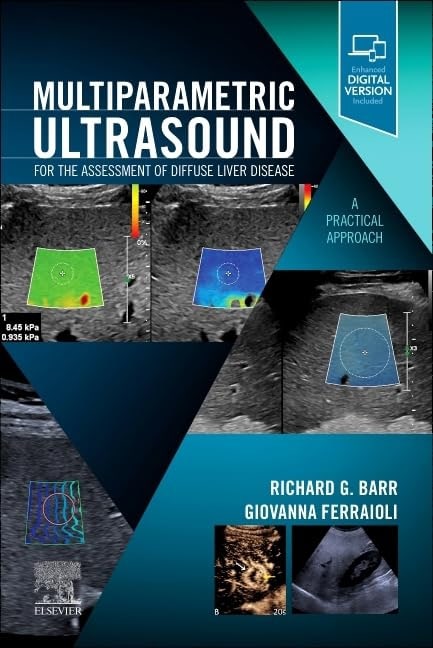 Multiparametric Ultrasound For The Assessment Of Diffuse Liver Disease A Practical Approach With Access Code (Pb 2024)