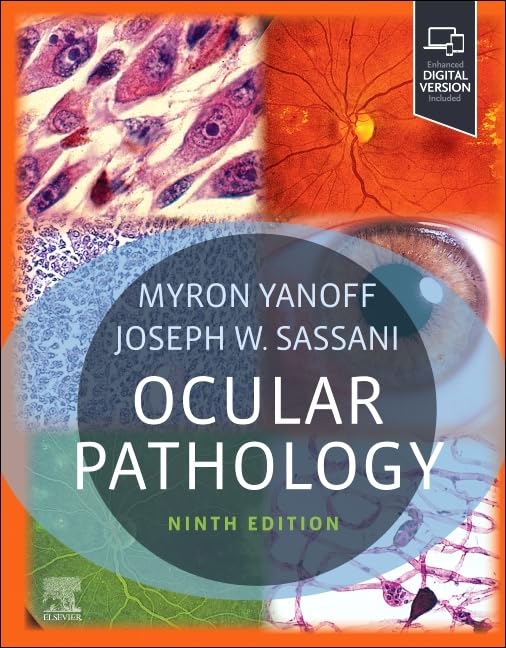 Ocular Pathology With Access Code 9Ed (Hb 2025)