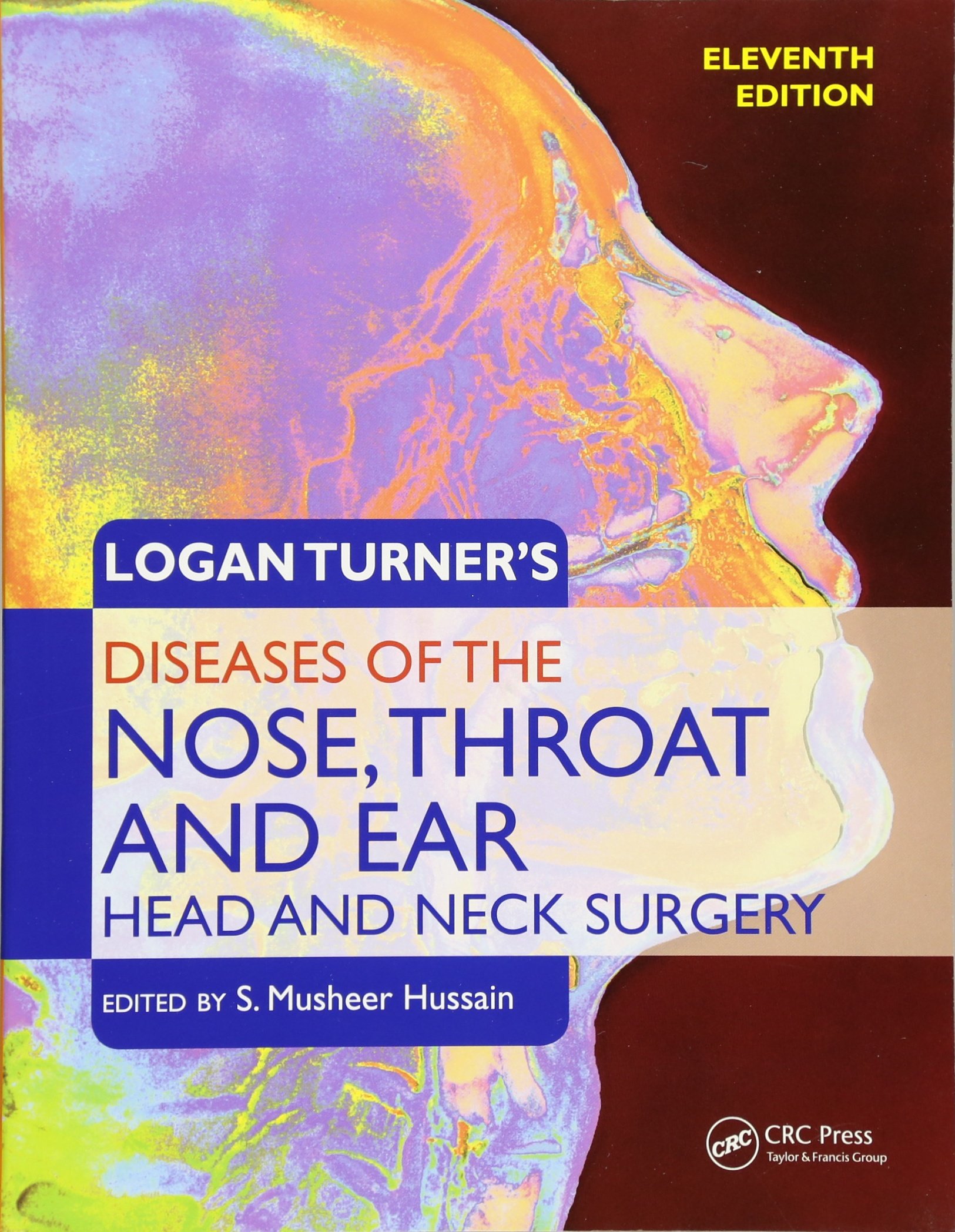 Logan Turner'S Diseases Of The Nose, Throat And Ear Head And Neck Surgery