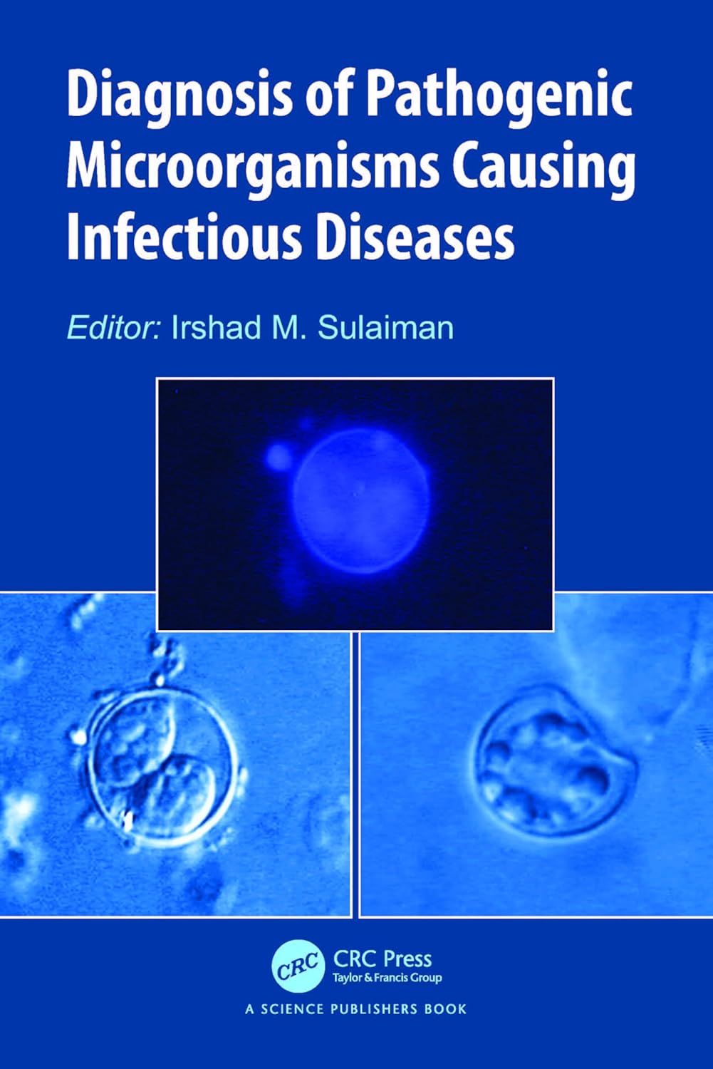Diagnosis Of Pathogenic Microorganisms Causing Infectious Diseases (Hb 2024)