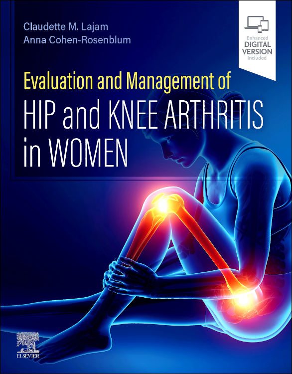Evaluation And Management Of Hip And Knee Arthritis In Women With Access Code (Pb 2026)