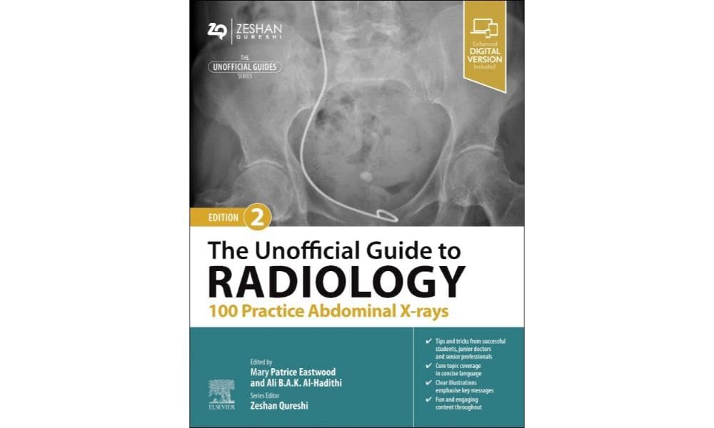 The Unofficial Guide to Radiology: 100 Practice Abdominal X-rays, 2/e