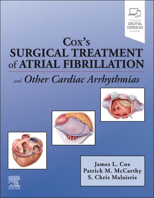 Coxs Surgical Treatment Of Atrial Fibrillation And Other Cardiac Arrhythmias (Pb 2026)