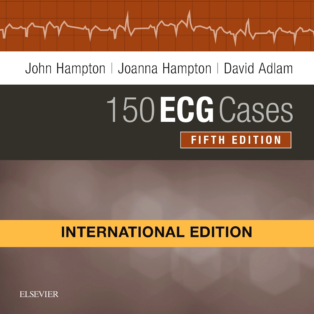 150 Ecg Cases, International Edition, 5E