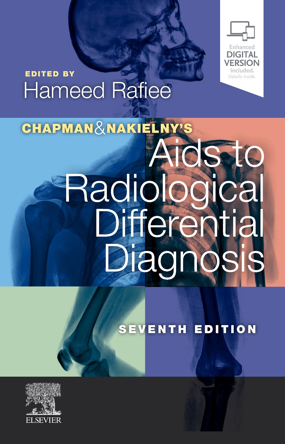 Chapman & Nakielny'S Aids To Radiological Differential Diagnosis