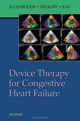 Device Therapy For Congestive Heart Failure