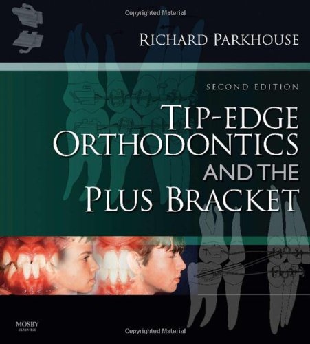 Tip-Edge Orthodontics and the Plus Bracket, 2e