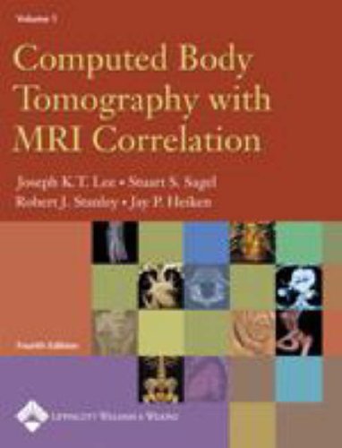 Computed Body Tomography With Mri Correlation (2 Volume Set) (Old)