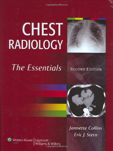 Chest Radiology : The Essentials 2/Ed (OLD Edition)