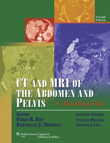 Ct And Mri Of The Abdomen And Pelvis (Lww Teaching File Series)(Old Edition)