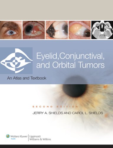 Eyelid, Conjunctival, And Orbital Tumors 2/Ed 2 Vol. Set (OLD Edition)