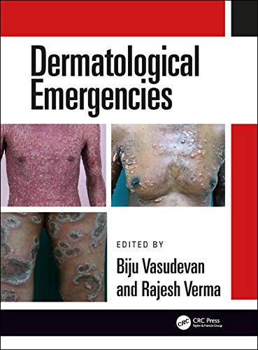 Dermatological Emergencies Hb2019