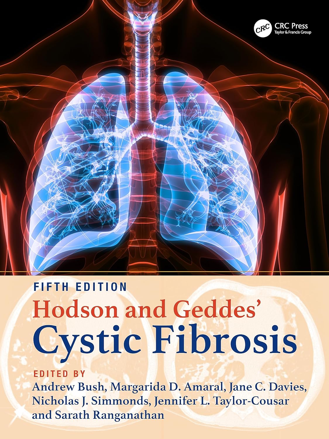 Hodson And Geddes Cystic Fibrosis 5Ed (Hb 2024)