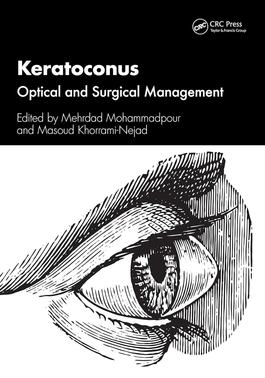 Keratoconus Optical And Surgical Management (Pb 2025)