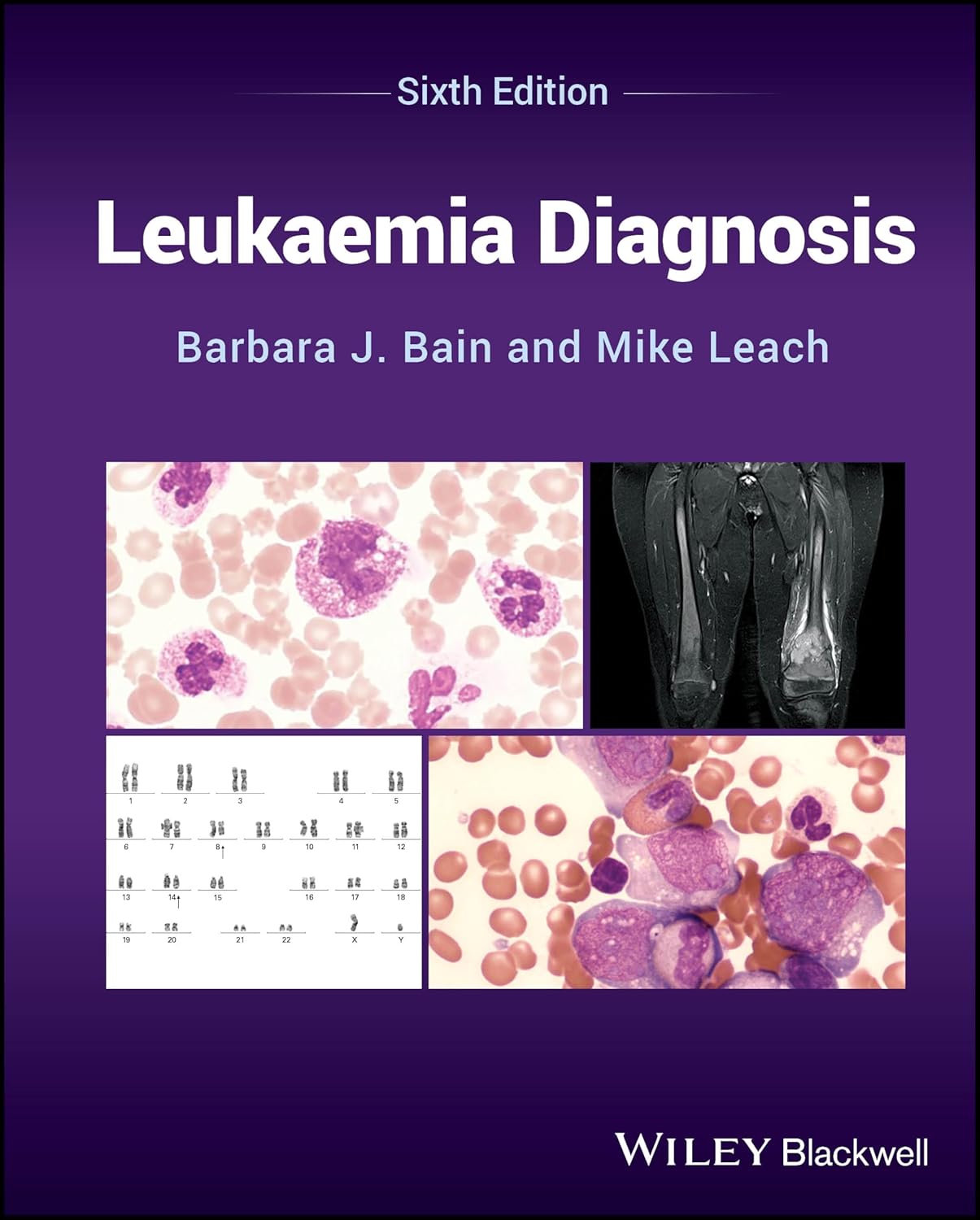 Leukaemia Diagnosis 6Ed (Hb 2024)