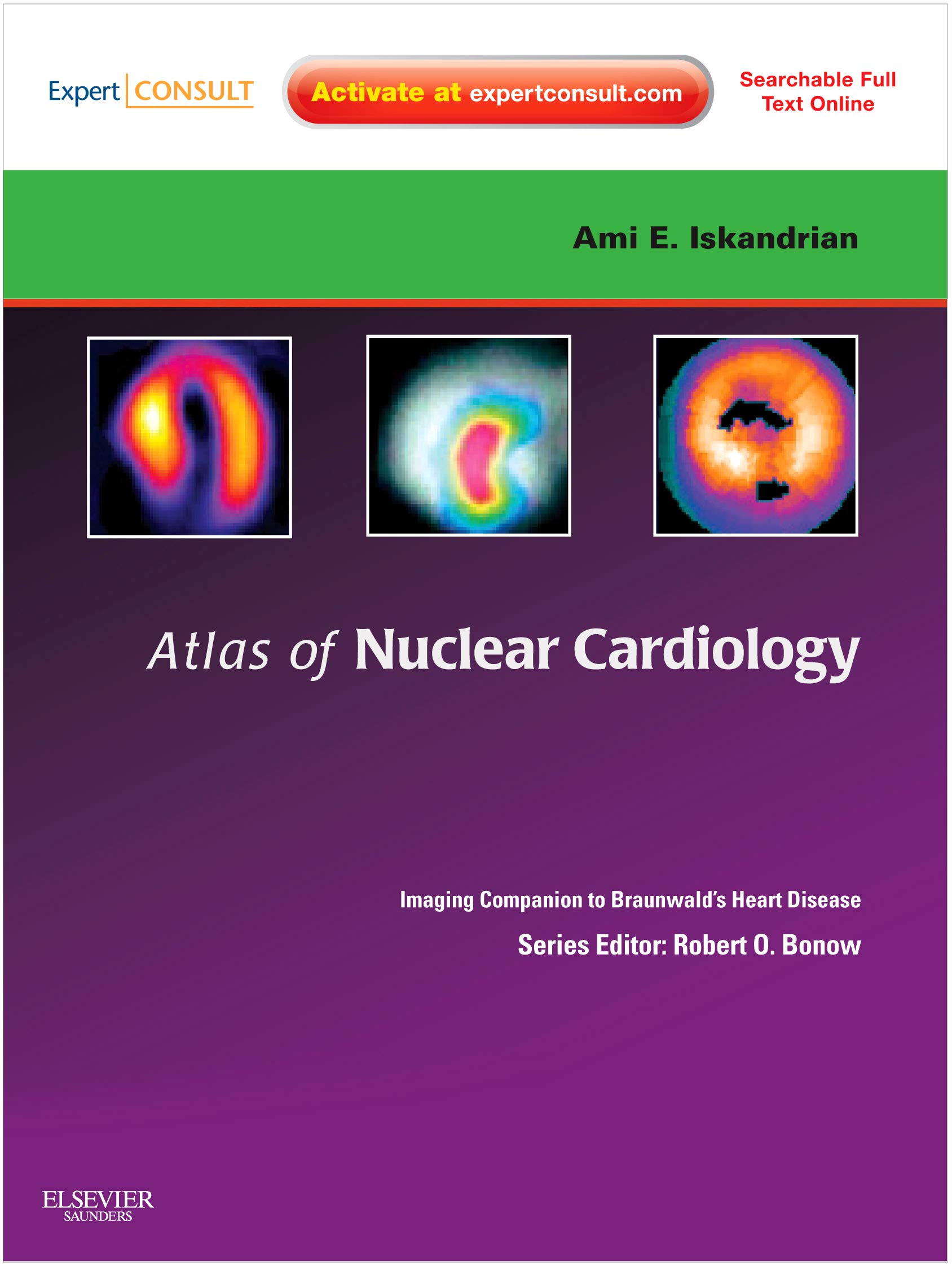 Atlas Of Nuclear Cardiology: Imaging Companion To Braunwald'S Heart Disease: Expert Consult - Online And Print