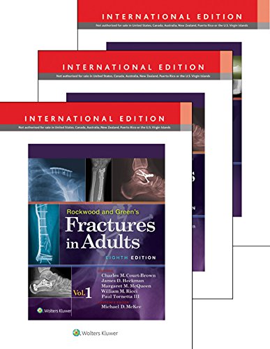 Rockwood, Green & Wilkins` Fractures In Adults & Children Package 8/E, 3 Vols. Set (OLD)
