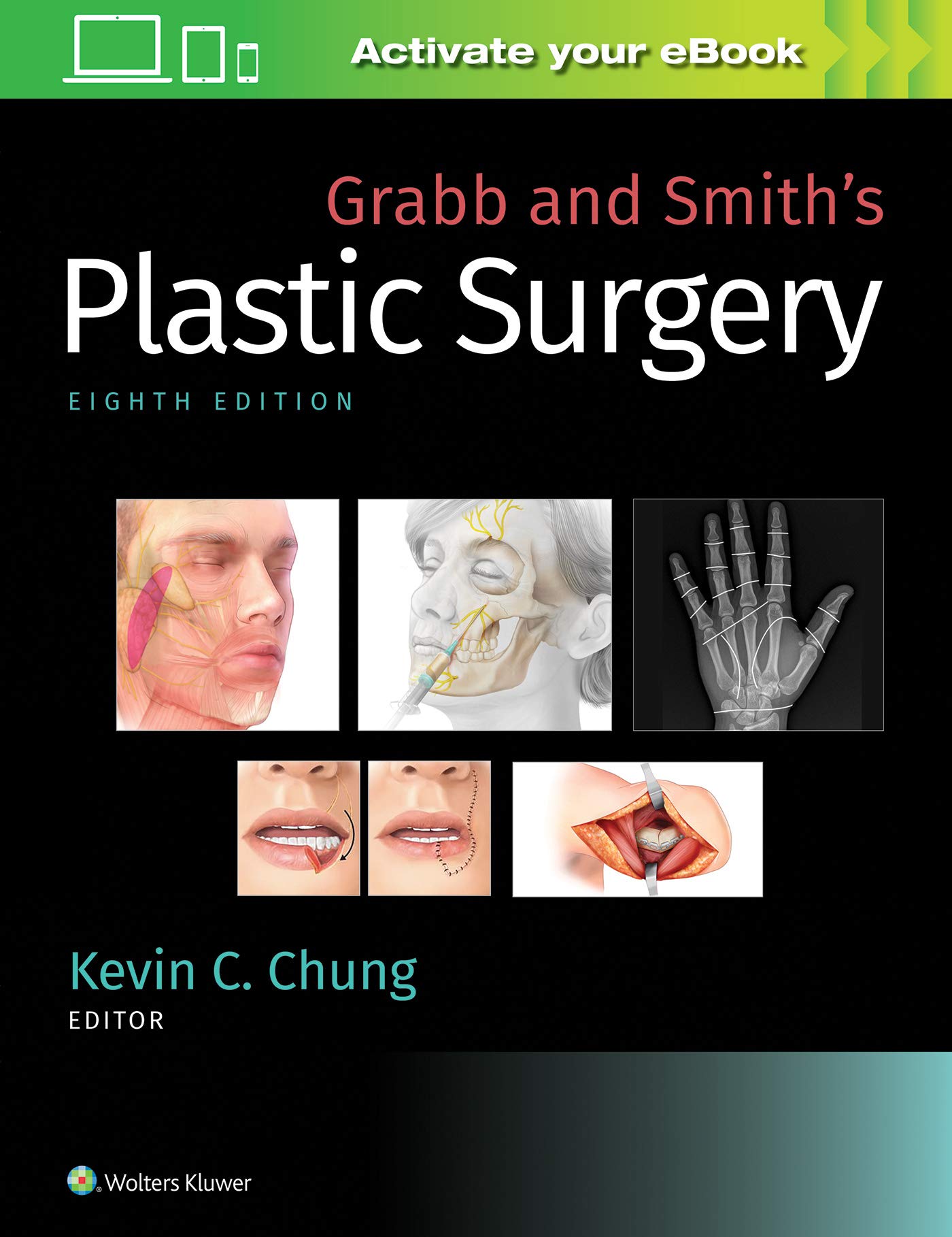 Grabb And Smith'S Plastic Surgery