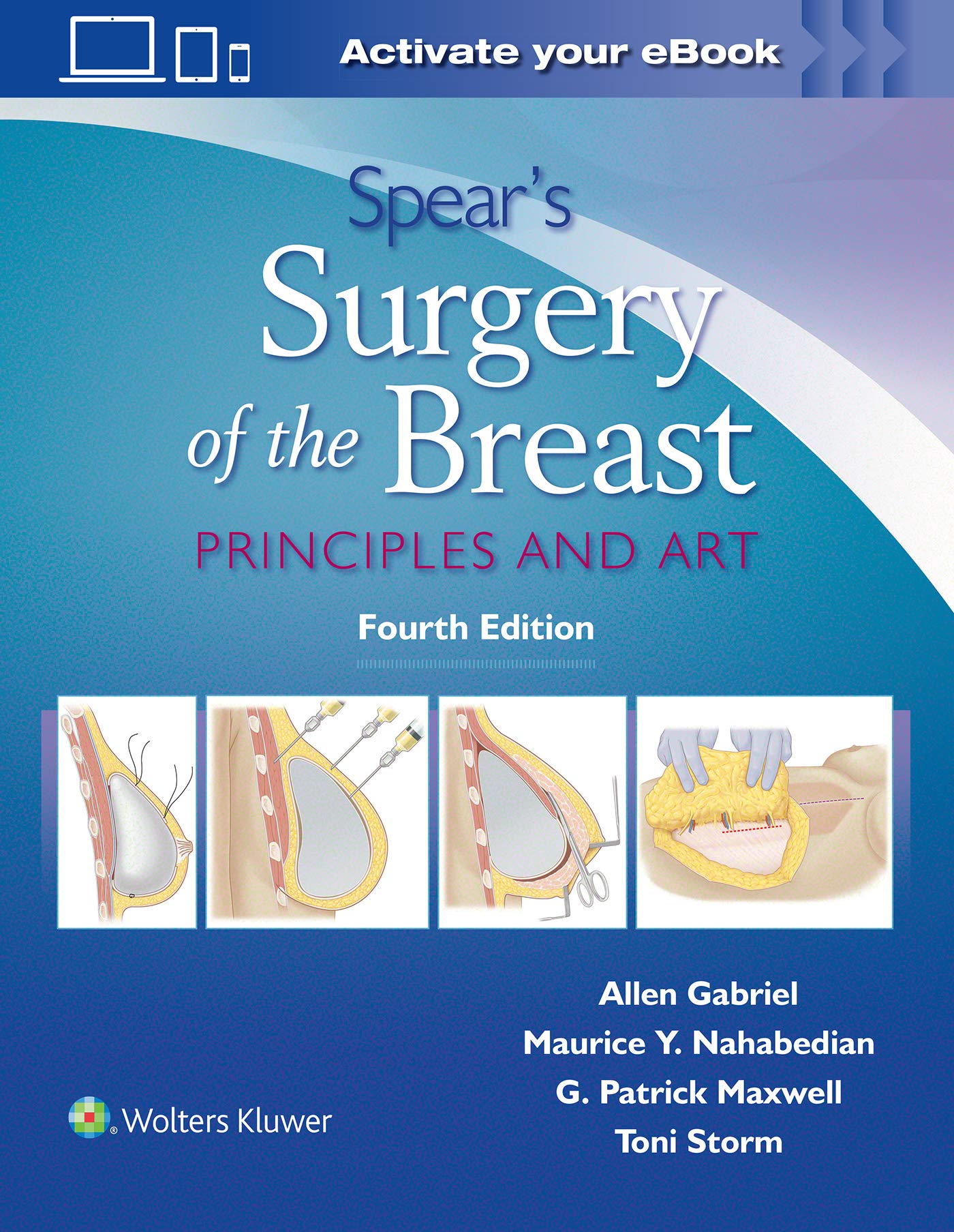 Spear'S Surgery Of The Breast: Principles And Art