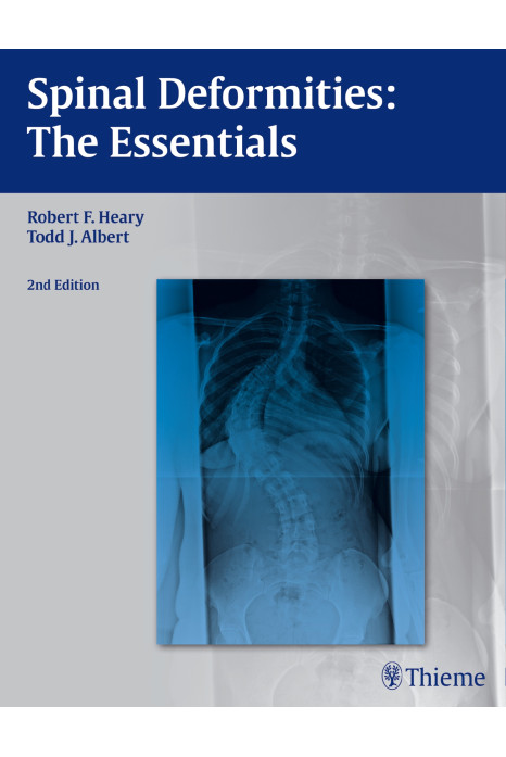 Spinal Deformities