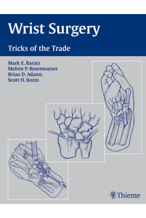 Wrist Surgery: Tricks of the Trade: 1/e