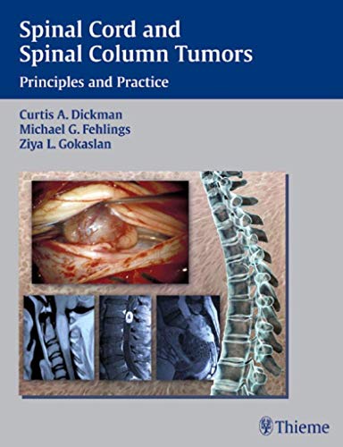 Spinal Cord and Spinal Column Tumors