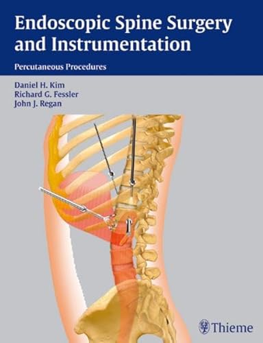 Endoscopic Spine Surgery and Instrumentation