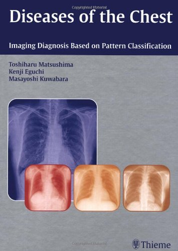 Diseases Of The Chest: Imaging Diagnosis Based On Pattern Classification 1/E