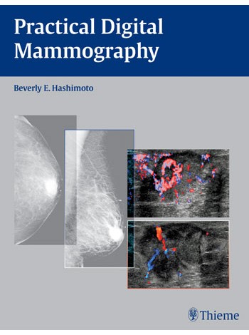 Practical Digital Mammography: 1/e
