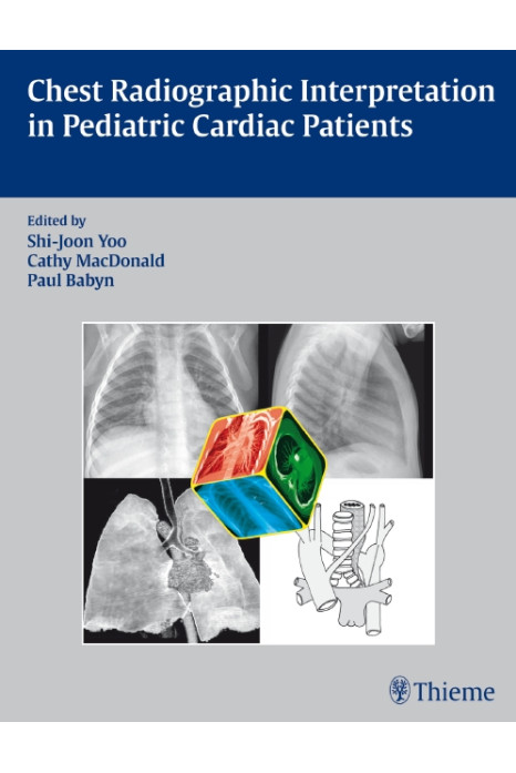 Chest Radiographic Interpretation in Pediatric Cardiac Patients