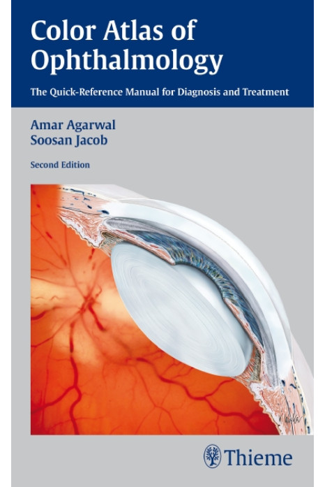 COLOR ATLAS OF OPHTHALMOLGY