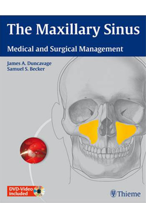 The Maxillary Sinus