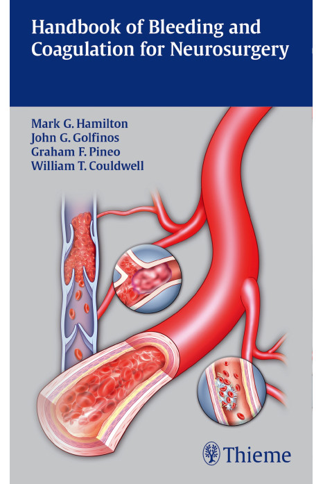 Handbook of Bleeding and Coagulation for Neurosurgery