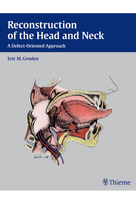 Reconstruction of the Head and Neck