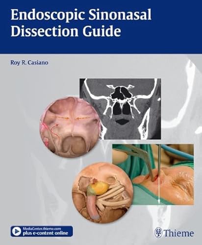 Endoscopic Sinonasal Dissection Guide